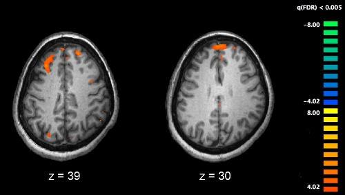 Two cross-sections of a brain, viewed from above. In each cross-section, one or two small regions (indicated with orange blobs) are active.